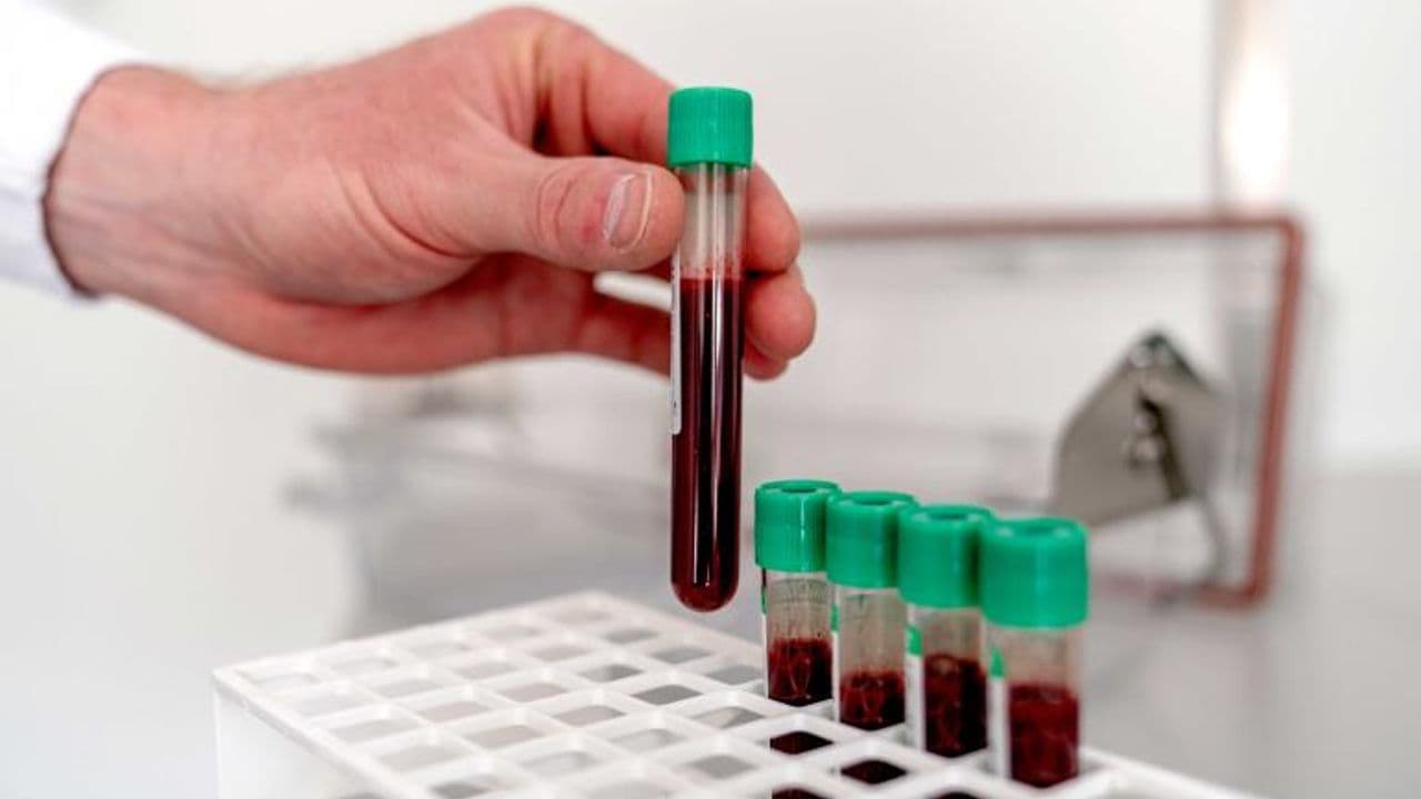 Muestras de sangre
