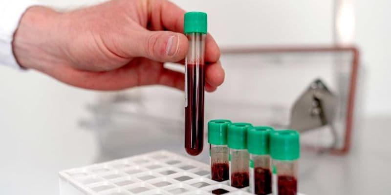 Muestras de sangre
