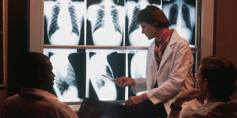 Investigadores holandeses usan IA para predecir nuevos infartos